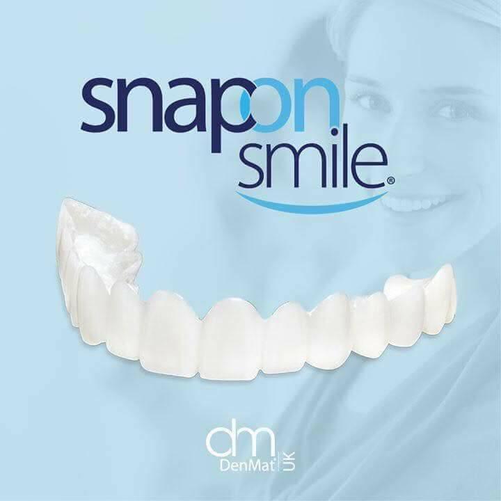 Răng thẩm mỹ Snap on Smile 