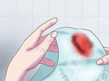 Đại tiện ra máu tươi kèm đau rát hậu môn trực tràng là dấu hiệu nhận biết của bệnh gì?